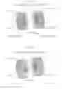 Fig. 45 - Power transmission apparatus and method, and resonance device used therein