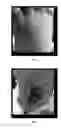 Fig. 02 - METHOD FOR MAKING A TOPICAL COMPOSITION COMPRISING GROWTH FACTORS DERIVED FROM HUMAN UMBILICAL CORD BLOOD PLATELETS