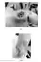 Fig. 04 - METHOD FOR MAKING A TOPICAL COMPOSITION COMPRISING GROWTH FACTORS DERIVED FROM HUMAN UMBILICAL CORD BLOOD PLATELETS