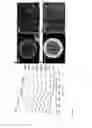 Fig. 06 - Highly sinter-stable metal nanoparticles supported on mesoporous graphitic particles and their use