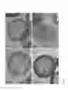 Fig. 08 - Highly sinter-stable metal nanoparticles supported on mesoporous graphitic particles and their use