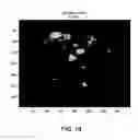 Fig. 22 - Cell Culture Strain Array Systems and Methods for Using the Same