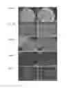 Fig. 05 - METHOD FOR CULTURING PLURIPOTENT STEM CELL, AND POLYPEPTIDE TO BE USED THEREFOR