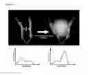 Fig. 48 - Environmentally sensitive compositions and methods of use in the treatment and diagnosis of tumors
