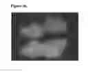 Fig. 51 - Environmentally sensitive compositions and methods of use in the treatment and diagnosis of tumors