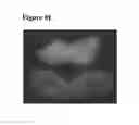 Fig. 52 - Environmentally sensitive compositions and methods of use in the treatment and diagnosis of tumors