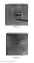 Fig. 03 - Method of treating leukemia using rice prolamin