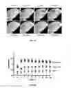 Fig. 12 - Methods of Treating Neurological Diseases