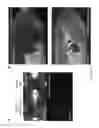 Fig. 15 - CELLULOSE-/CHITIN-TYPE POLYMERIC LIGHT-EMITTING MATERIAL