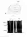Fig. 07 - Filtration and extraction assembly