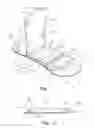 Fig. 02 - Double notched catheter securement assembly