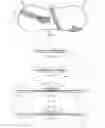 Fig. 05 - Double notched catheter securement assembly