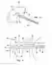 Fig. 03 - Arthroscopic meniscal repair systems and methods
