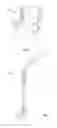Fig. 02 - Devices and methods for inserting a vertebral fixation member