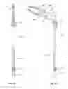 Fig. 15 - Devices and methods for inserting a vertebral fixation member