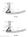 Fig. 26 - Devices and methods for inserting a vertebral fixation member
