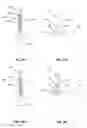 Fig. 31 - Devices and methods for inserting a vertebral fixation member