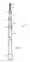 Fig. 02 - Partition mount with integrated plunger assembly