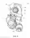 Fig. 04 - Turbocharging device of engine for vehicle