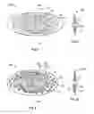Fig. 06 - In situ channelization method and system for increasing fracture conductivity