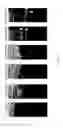 Fig. 02 - Orientation-aware average intensity histogram to indicate object boundary depth in ultrasound images
