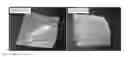Fig. 01 - SILK MEDICAL DEVICES
