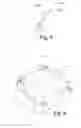 Fig. 04 - Dental prosthesis, in particular on implants, optionally for the replacement of an entire dental arch, method and kit for making it