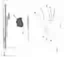 Fig. 07 - Computer-implemented dental restoration design