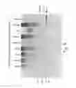 Fig. 09 - ENDOTHELIAL-MONOCYTE ACTIVATING POLYPEPTIDE II (EMAP-II), A BIOMARKER FOR USE IN DIAGNOSIS AND TREATMENT OF BRAIN INJURY