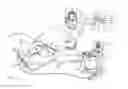 Fig. 02 - Adaptive electrode for bi-polar ablation