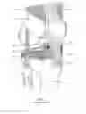 Fig. 02 - Quadriceps tendon stripper