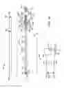 Fig. 14 - Vaso-occlusive device delivery system