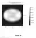 Fig. 17 - Systems and methods for the treatment of eye conditions