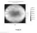 Fig. 22 - Systems and methods for the treatment of eye conditions