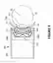 Fig. 23 - Systems and methods for the treatment of eye conditions