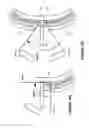 Fig. 40 - Systems and methods for the treatment of eye conditions