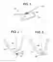 Fig. 02 - Pursestring Epicardial Pad Device