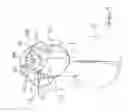 Fig. 05 - ORTHOPAEDIC FIXATION COMPONENT AND METHOD