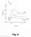 Fig. 07 - Electro-acoustic stimulation systems that perform predetermined actions in accordance with evoked responses
