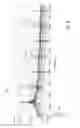 Fig. 09 - Implant encapsulation