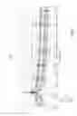 Fig. 10 - Implant encapsulation