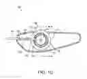 Fig. 03 - Wire collection device for stent delivery system
