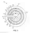 Fig. 06 - Wire collection device for stent delivery system