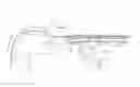 Fig. 01 - Stent delivery device