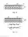 Fig. 09 - Bioabsorbable implants
