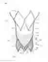 Fig. 01 - STENT WITH ALTERNATIVE CELL SHAPES