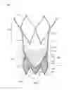 Fig. 04 - STENT WITH ALTERNATIVE CELL SHAPES