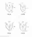 Fig. 05 - STENT WITH ALTERNATIVE CELL SHAPES