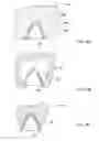 Fig. 12 - System and method for manufacturing a dental prosthesis and a dental prosthesis manufactured thereby