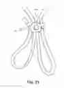 Fig. 22 - Shoestring Lock